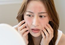 Rosacea vagy érzékeny bőr? Így tegyél különbséget!